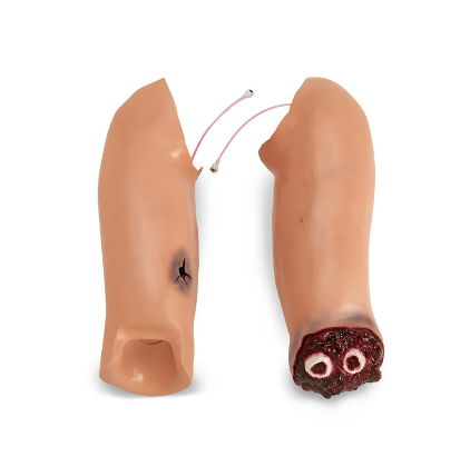 Trauma Randy Arm Flash Moulage - Nasco