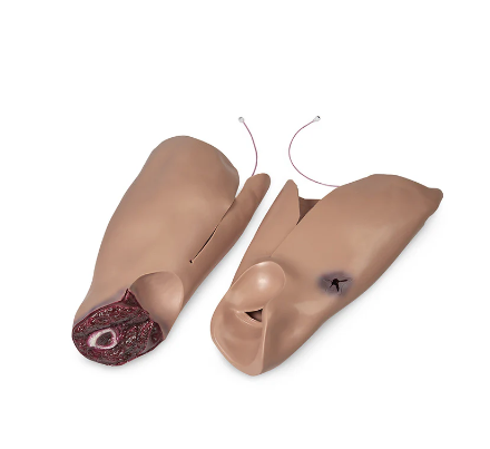 Trauma Randy Leg Flash Moulage  - Nasco