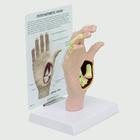Osteoarthritis Hand Model