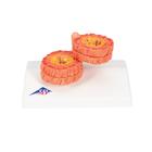 COPD Model