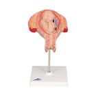 Fetus, month 5, breech position