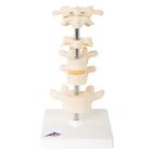 6 Mounted Vertebrae